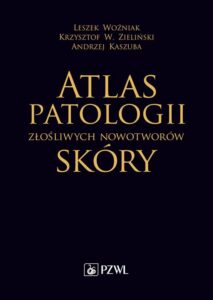 Okładka: Atlas patologii złośliwych nowotworów skóry