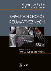 Okładka: Diagnostyka obrazowa zapalnych chorób reumatycznych