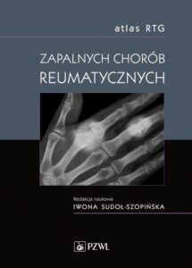 Okładka: Atlas RTG zapalnych chorób reumatycznych
