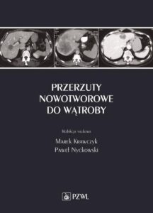 Okładka: Przerzuty nowotworowe do wątroby