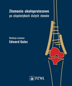 Okładka: Złamania okołoprotezowe po aloplastykach dużych stawów