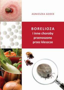 Okładka: Borelioza i inne choroby przenoszone przez kleszcze