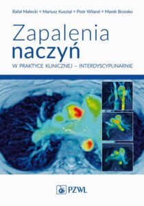 Okładka: Zapalenia naczyń w praktyce klinicznej interdyscyplinarnie. Diagnostyka i leczenie