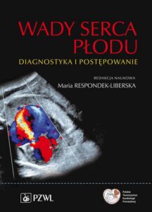Okładka: Wady serca płodu. Diagnostyka i postępowanie