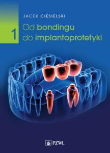 Okładka: Od bondingu do implantoprotetyki Część 1