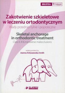 Okładka: Zakotwienie szkieletowe w leczeniu ortodontycznym. Wady przednio-tylne i poprzeczne