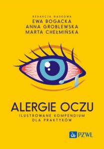 Okładka: Alergie oczu. Ilustrowane kompendium dla praktyków
