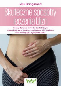 Okładka: Skuteczne sposoby leczenia blizn